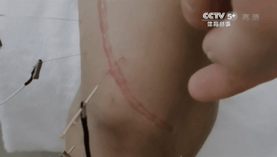 中国上最惨的举重冠军_举重冠军悲惨_最惨举重冠军